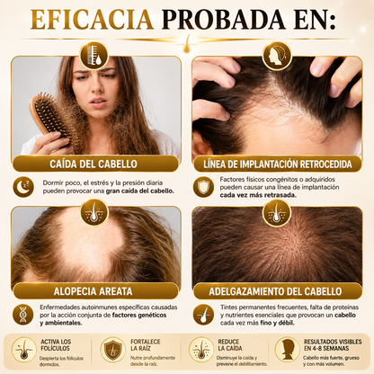 Esencia Anticaída Para El Crecimiento Del Cabello Con Biotina y Queratina