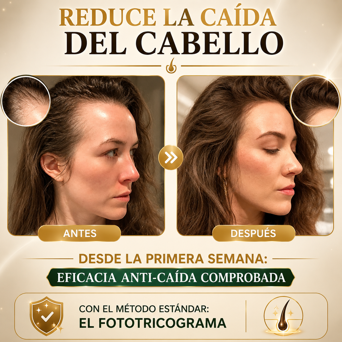 Esencia Anticaída Para El Crecimiento Del Cabello Con Biotina y Queratina