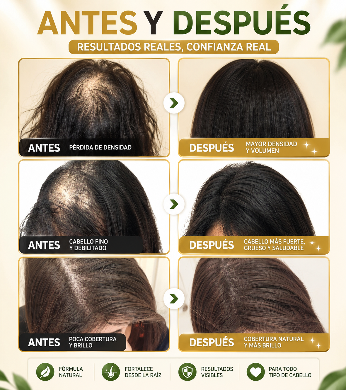 Esencia Anticaída Para El Crecimiento Del Cabello Con Biotina y Queratina